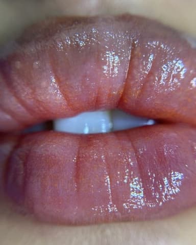 lips