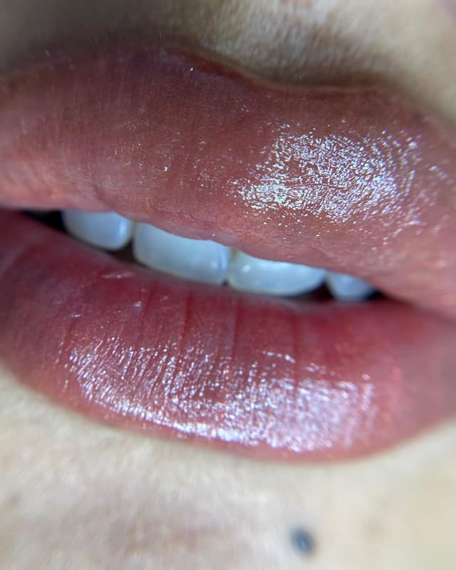 lips