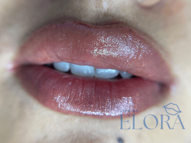 Dark Lip Correction by Elora's PMU