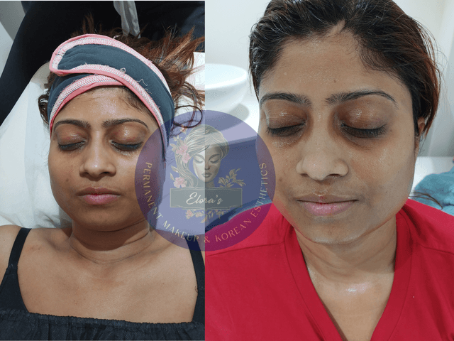 Glow Ritual Treatment Image