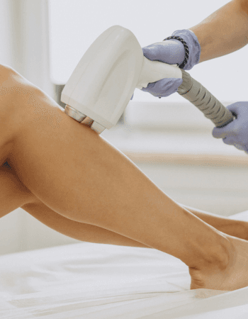 Laser hair removal